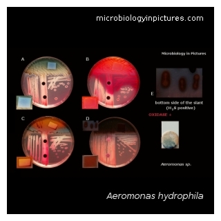 aeromonas